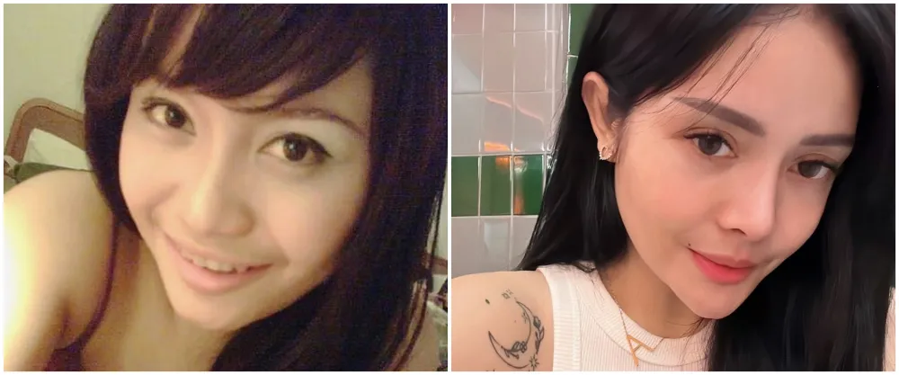 mawar afi sebelum dan sesudah operasi plastik © berbagai sumber