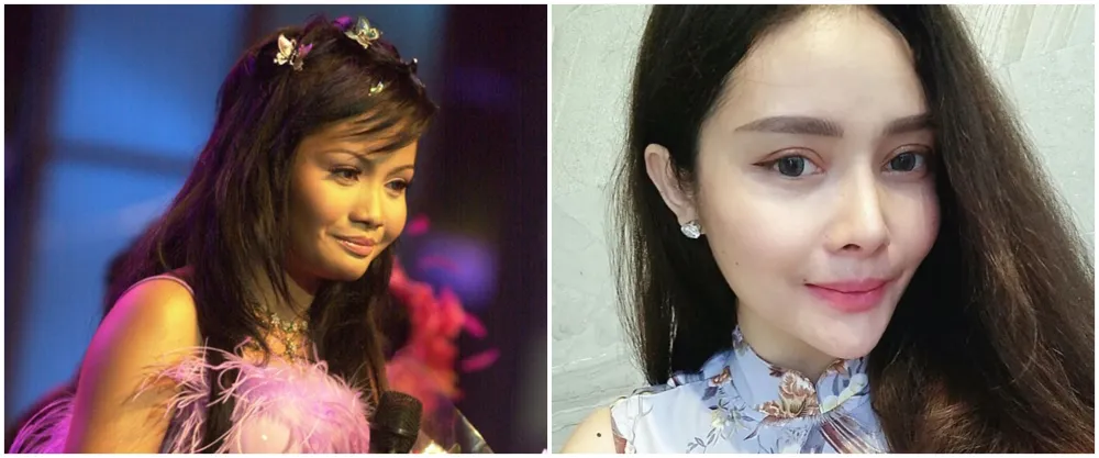 mawar afi sebelum dan sesudah operasi plastik © berbagai sumber