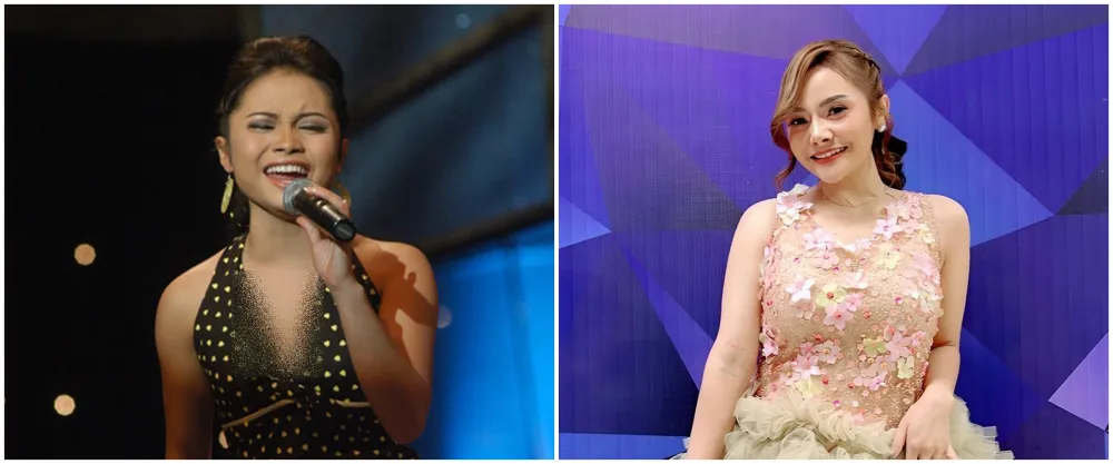 mawar afi sebelum dan sesudah operasi plastik © berbagai sumber