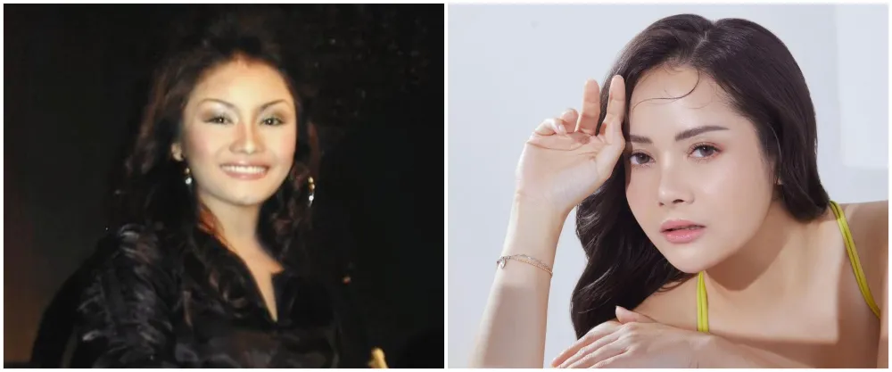 mawar afi sebelum dan sesudah operasi plastik © berbagai sumber