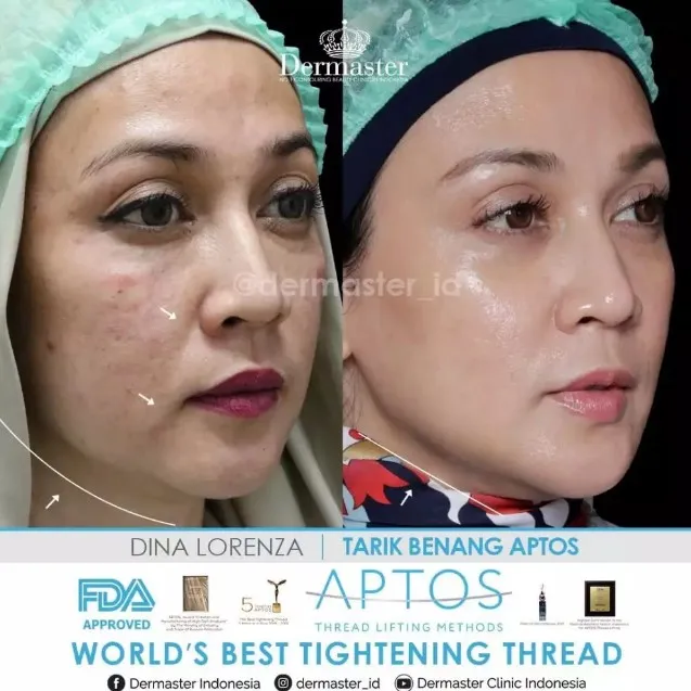 Dina Lorenza glowing tanpa makeup © Instagram Dina Lorenza glowing tanpa makeup © Instagram