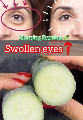 Atasi mata bengkak dan sembap pakai timun Berbagai sumber