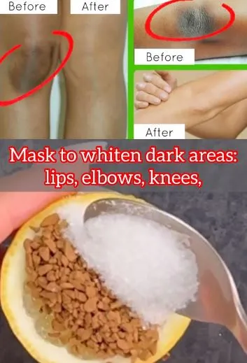 Bikin scrub pemutih siku dan lutut Berbagai sumber