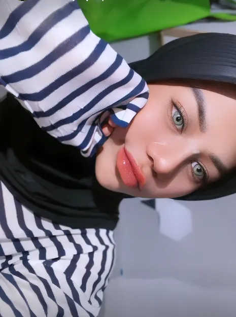 Potret terbaru Cimoy Montok usai oplas hidung © 2023 brilio.net