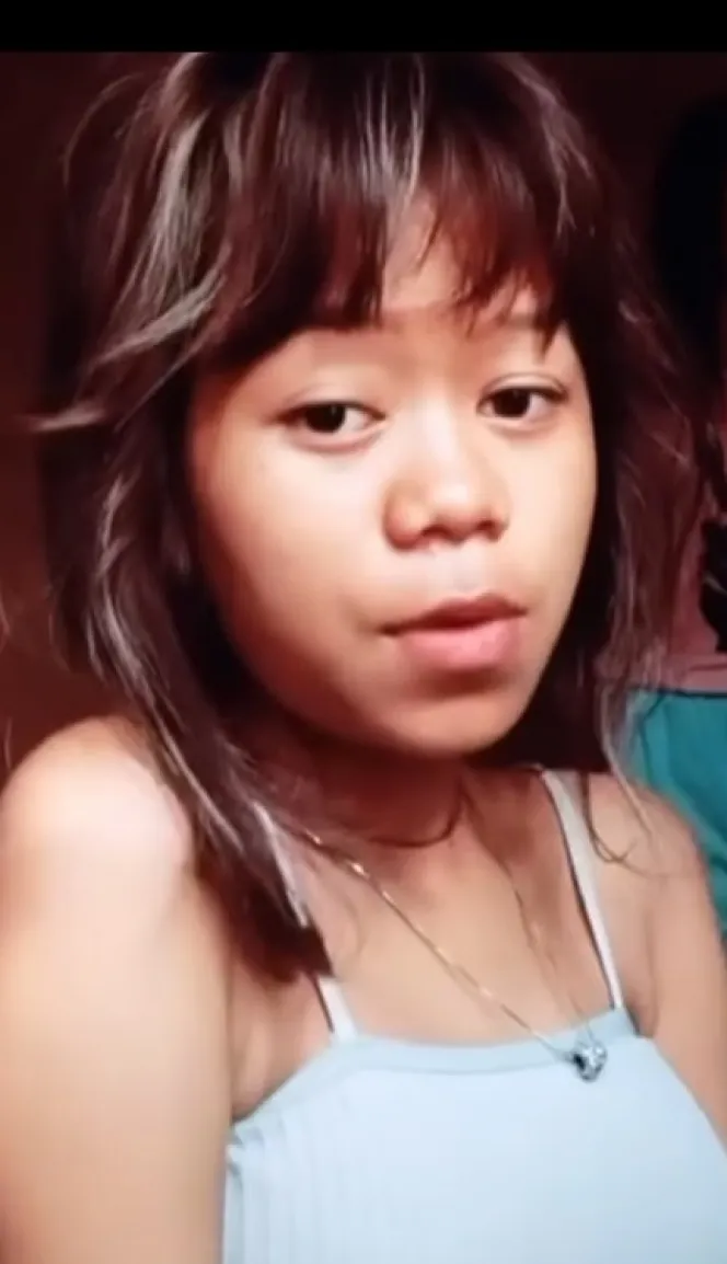 transformasi cimoy montok usai oplas © instagram