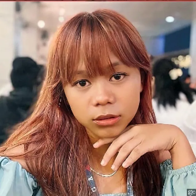 transformasi cimoy montok usai oplas © instagram