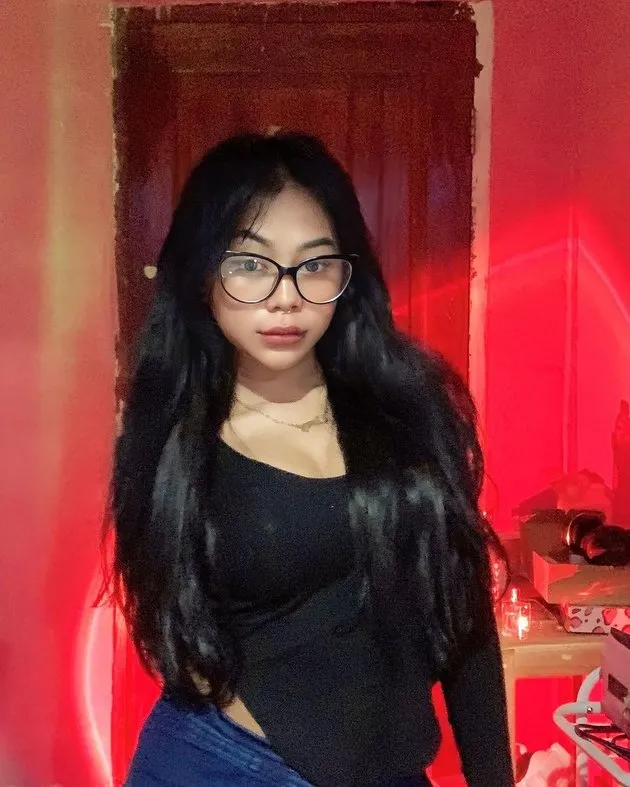 transformasi cimoy montok usai oplas © instagram