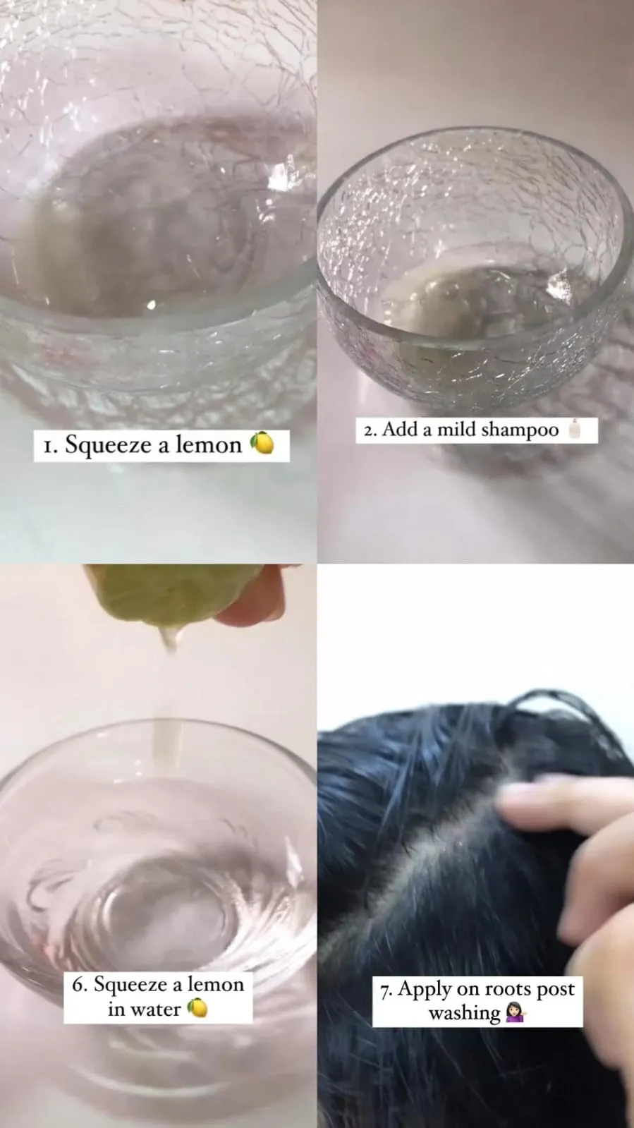 ketombe rasa gatal © Instagram ketombe rasa gatal © Instagram