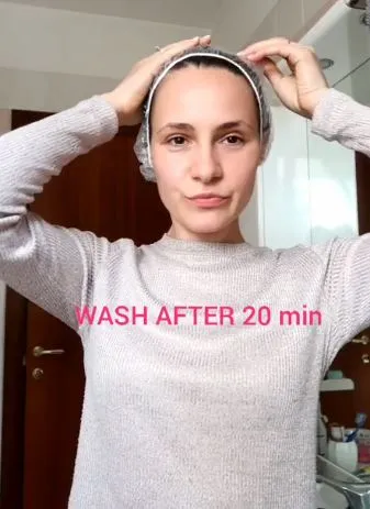 Atasi ketombe agar tak semakin banyak Berbagai sumber