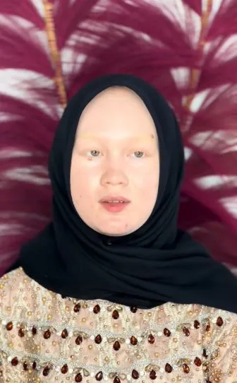 Transformasi makeup pengantin wanita albino berbagai sumber Transformasi makeup pengantin wanita albino berbagai sumber