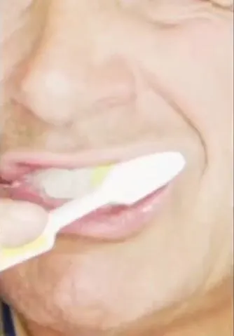 Hilangkan noda kekuningan pada gigi Berbagai sumber Hilangkan noda kekuningan pada gigi Berbagai sumber