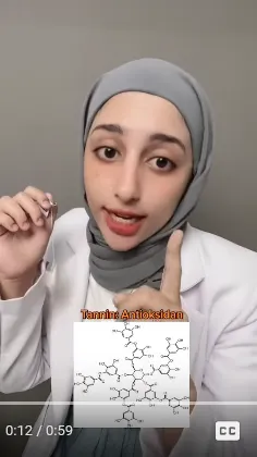 cara hilangkan lingkaran hitam di mata berbagai sumber