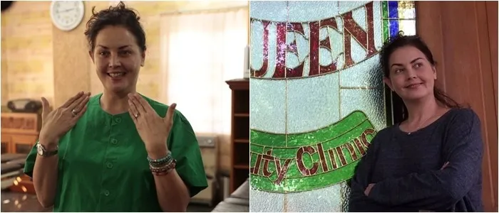 Seleb sebelum dan sesudah suntik botoks Berbagai sumber