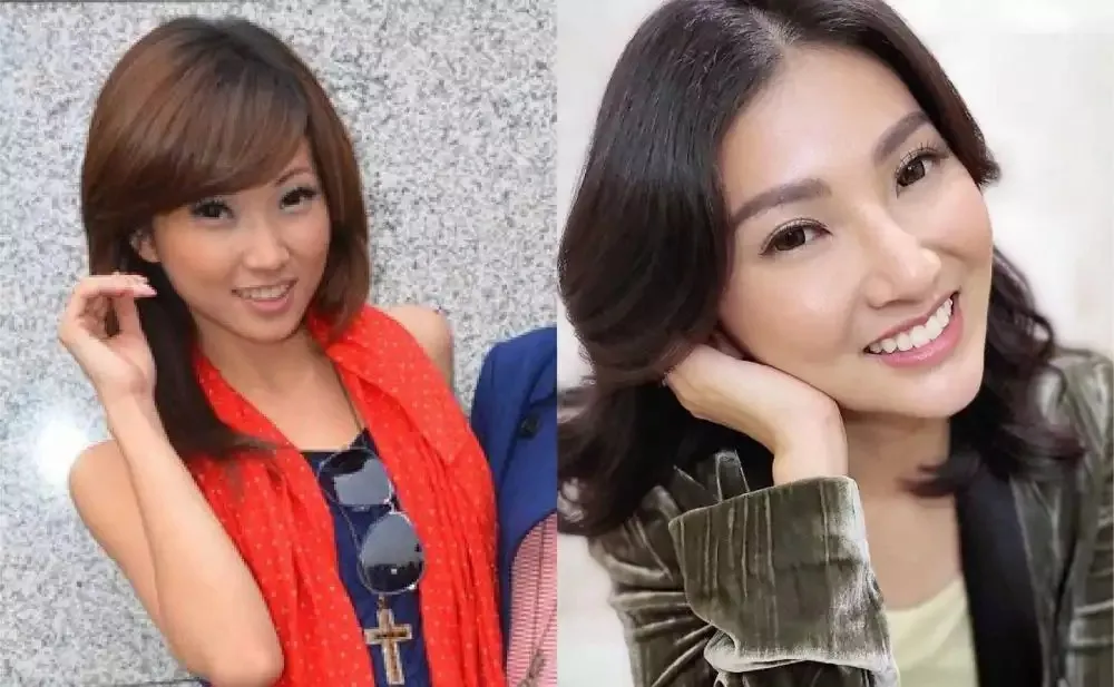 Seleb sebelum dan sesudah suntik botoks Berbagai sumber