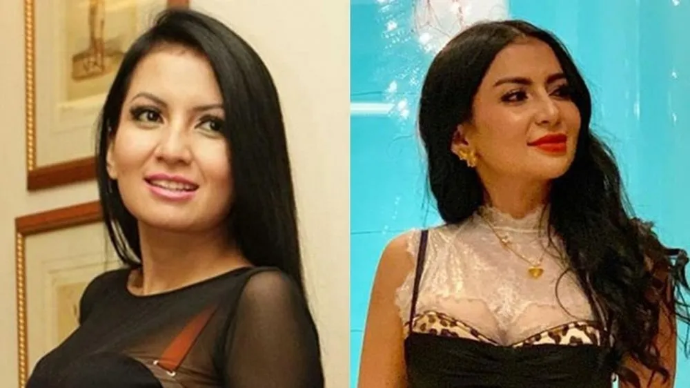 seleb sebelum dan sesudah filler bibir berbagai sumber