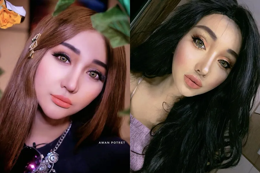 seleb sebelum dan sesudah filler bibir berbagai sumber