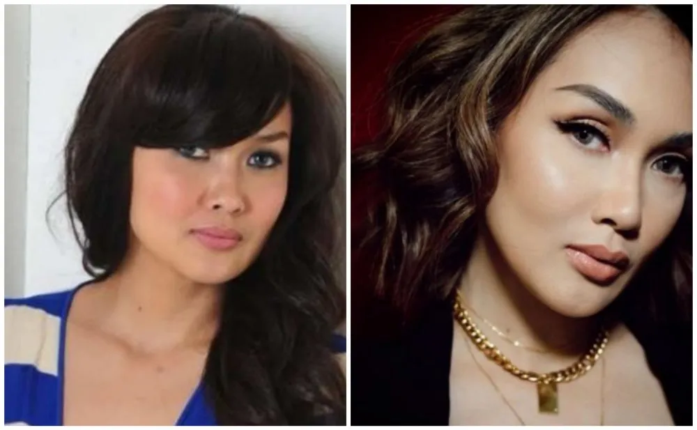 seleb sebelum dan sesudah filler bibir berbagai sumber