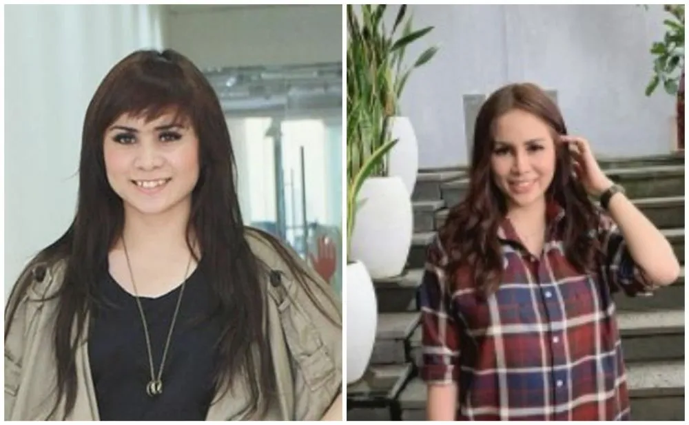 seleb sebelum dan sesudah filler bibir berbagai sumber