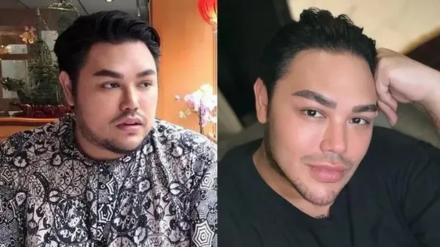 13 potret wajah seleb perubahan dagu Berbagai sumber