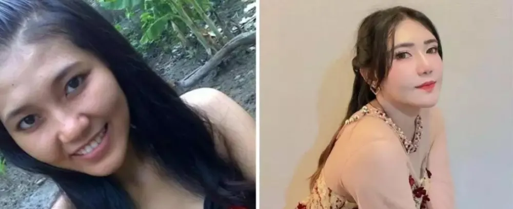 13 potret wajah seleb perubahan dagu Berbagai sumber