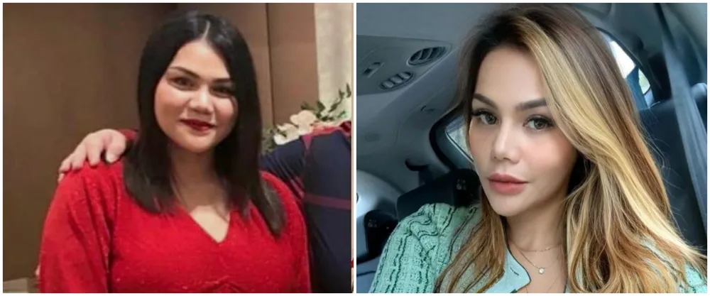 13 potret wajah seleb perubahan dagu Berbagai sumber