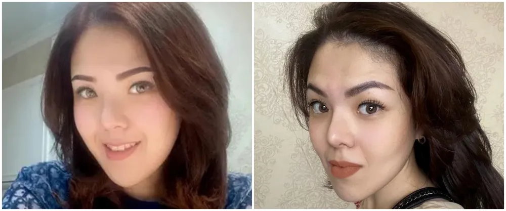 13 potret wajah seleb perubahan dagu Berbagai sumber