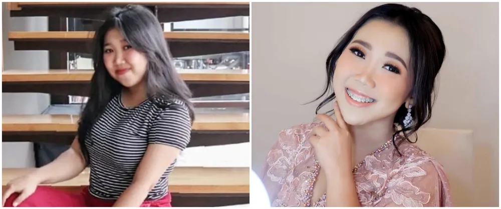 13 potret wajah seleb perubahan dagu Berbagai sumber