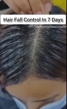 cara mengatasi rambut rontok berbagai sumber