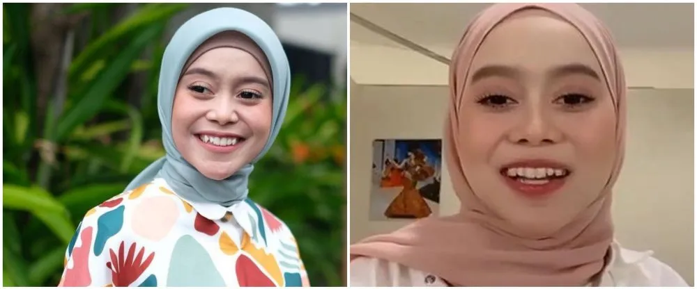 Seleb sebelum dan sesudah hilangkan gigi gingsul berbagai sumber