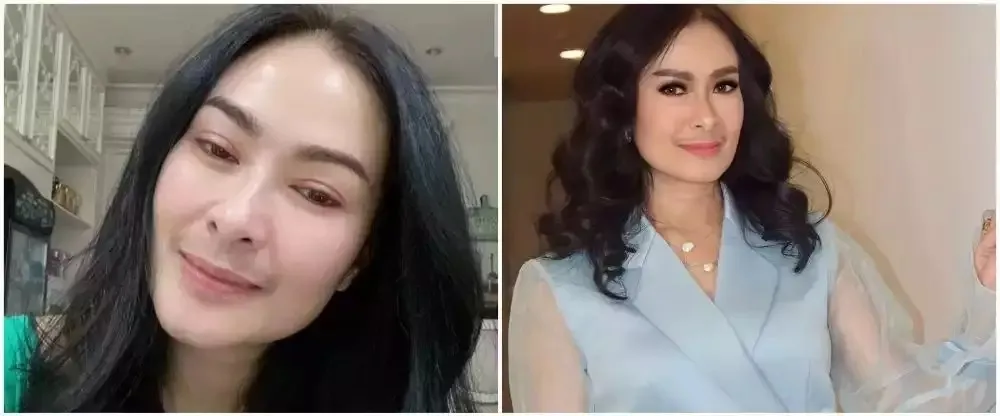 seleb usia 45 tahun suntik botoks Berbagai sumber seleb usia 45 tahun suntik botoks Berbagai sumber