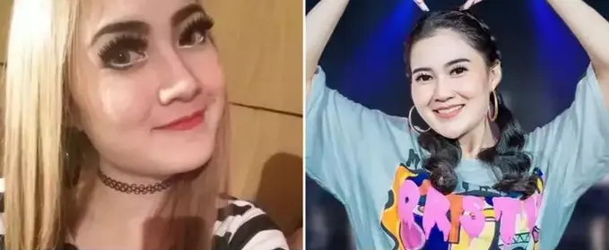 Sebelum dan sesudah tanam benang berbagai sumber Sebelum dan sesudah tanam benang berbagai sumber