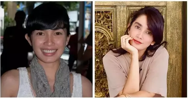 Sebelum dan sesudah tanam benang berbagai sumber Sebelum dan sesudah tanam benang berbagai sumber