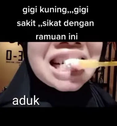 atasi gigi kuning ala YouTuber berbagai sumber