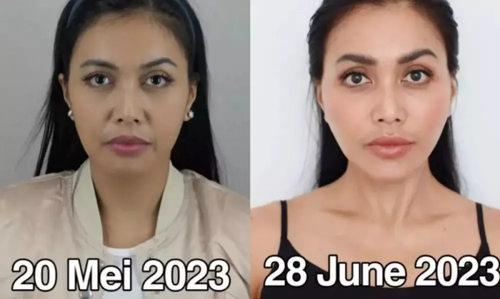 Seleb pilih oplas meski sudah cantik alami Berbagai sumber Seleb pilih oplas meski sudah cantik alami Berbagai sumber