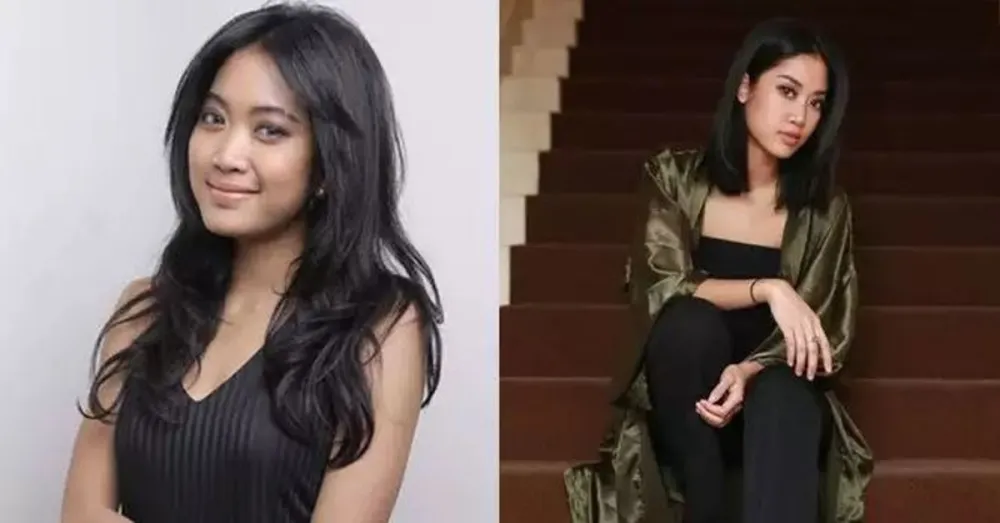 Seleb pilih oplas meski sudah cantik alami Berbagai sumber Seleb pilih oplas meski sudah cantik alami Berbagai sumber