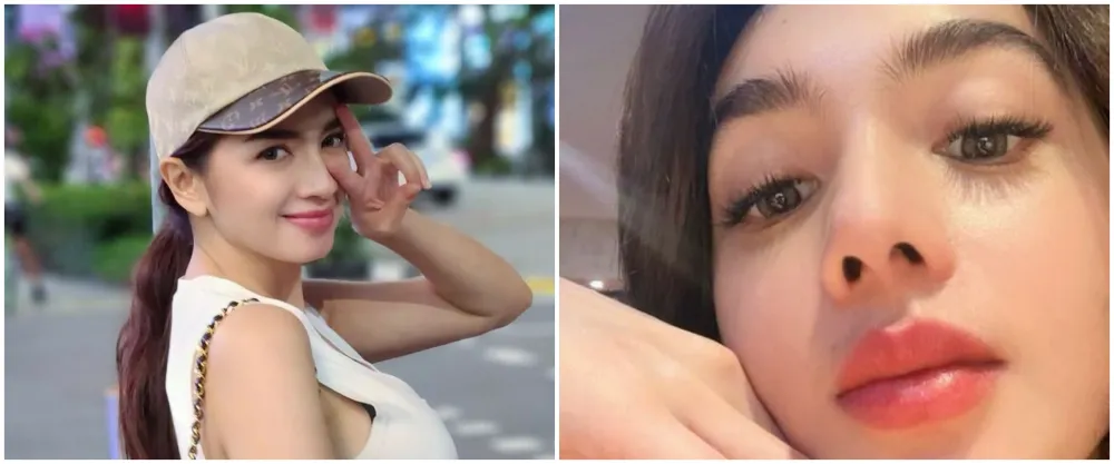 Seleb pilih oplas meski sudah cantik alami Berbagai sumber Seleb pilih oplas meski sudah cantik alami Berbagai sumber