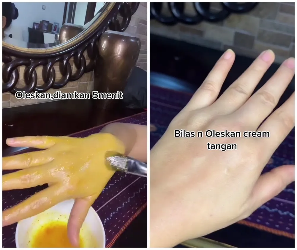 Cara mengatasi kulit tangan kering dan keriput © TikTok Cara mengatasi kulit tangan kering dan keriput © TikTok
