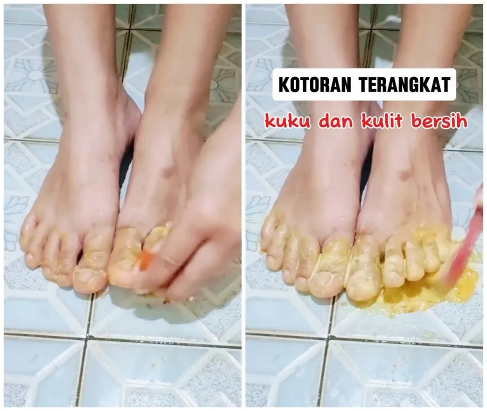 cara bersihkan kotoran kuku kaki © Instagram