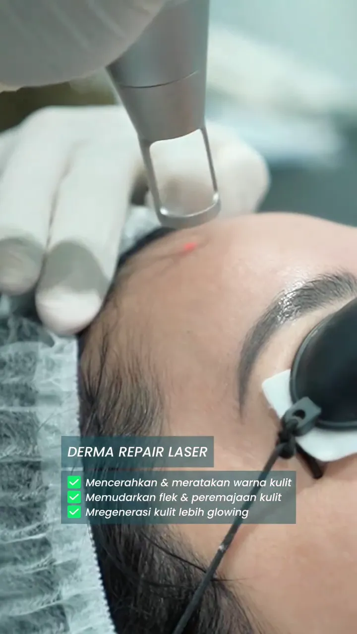 perawatan wajah Lulu Tobing © Instagram perawatan wajah Lulu Tobing © Instagram