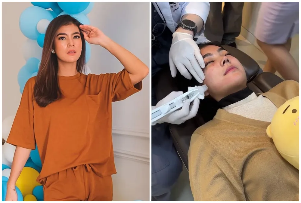 before-after Raya Kohandi usai jalani operasi © Instagram
