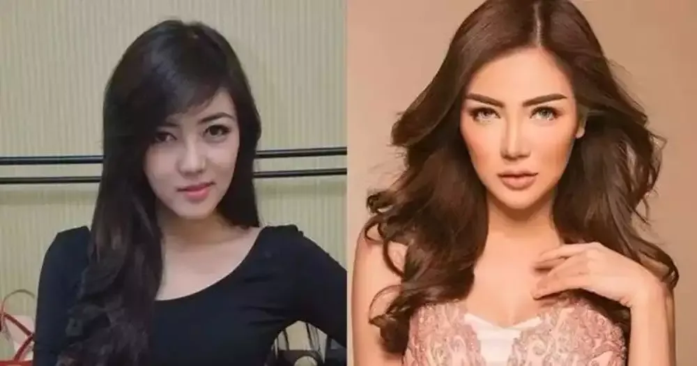 pilih oplas meski sudah cantik alami © 2025 brilio.net pilih oplas meski sudah cantik alami © 2025 brilio.net