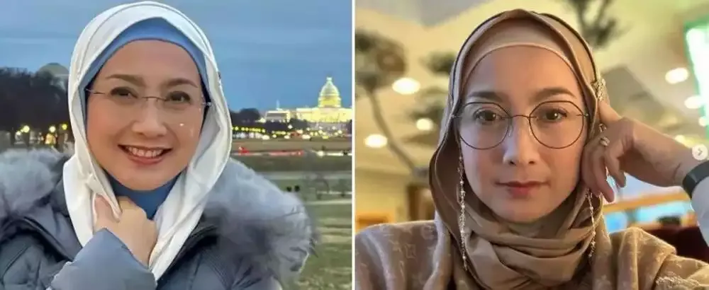 pilih oplas meski sudah cantik alami © 2025 brilio.net pilih oplas meski sudah cantik alami © 2025 brilio.net