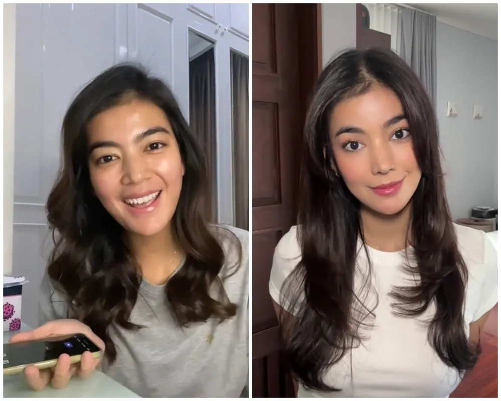 pilih oplas meski sudah cantik alami © 2025 brilio.net pilih oplas meski sudah cantik alami © 2025 brilio.net