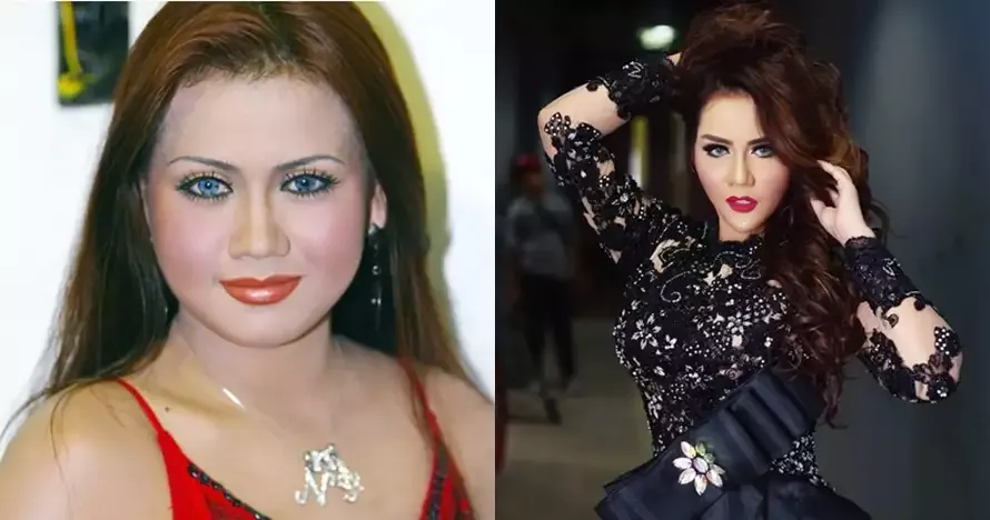 rewrite 25 seleb operasi plastik © 2025 brilio.net