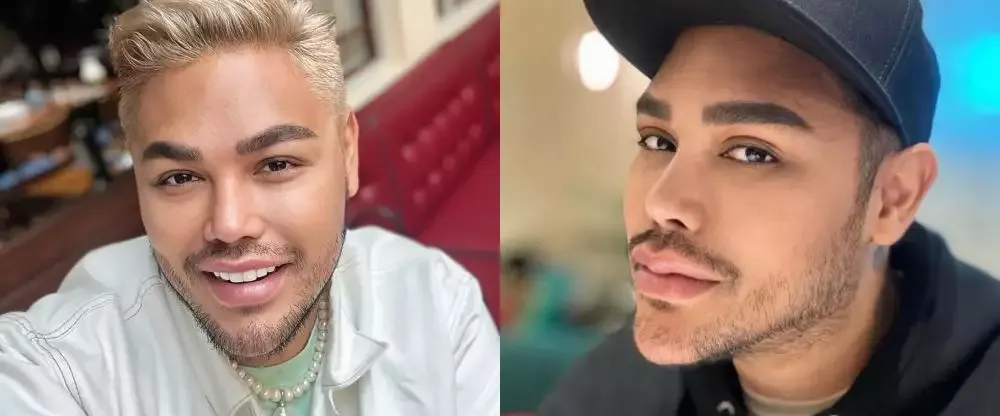 rewrite 25 seleb operasi plastik © 2025 brilio.net