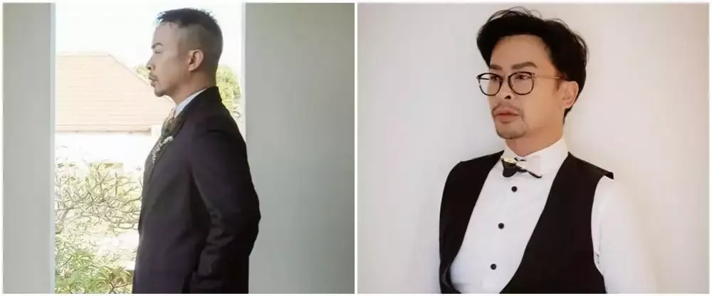 13 seleb transplantasi rambut © 2025 brilio.net 13 seleb transplantasi rambut © 2025 brilio.net