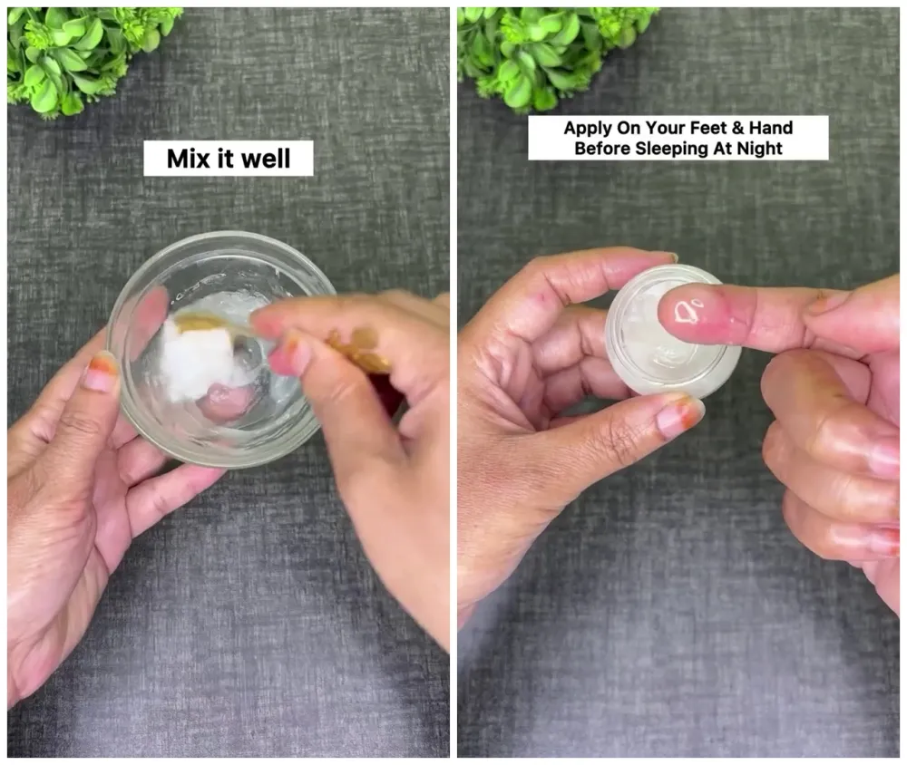 trik melembapkan kulit kering © Instagram