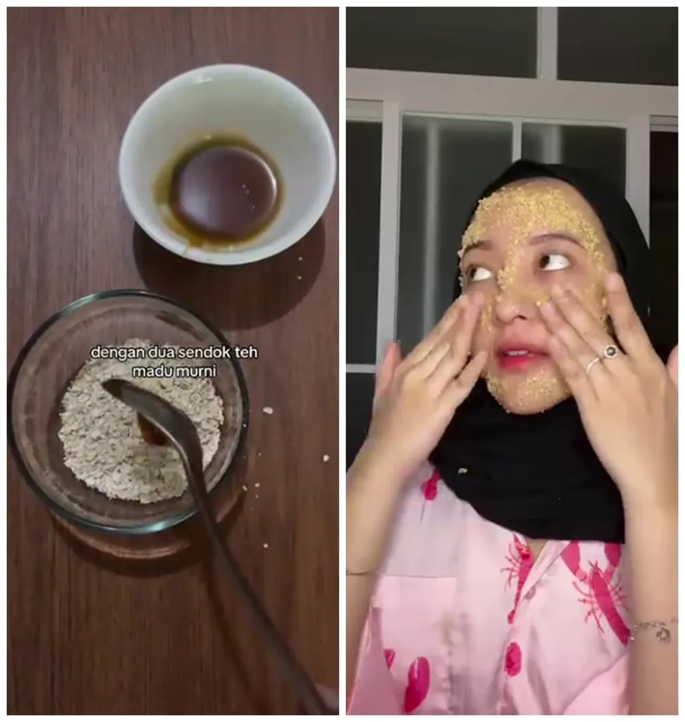 Cara hilangkan bekas jerawat dan komedo © Instagram