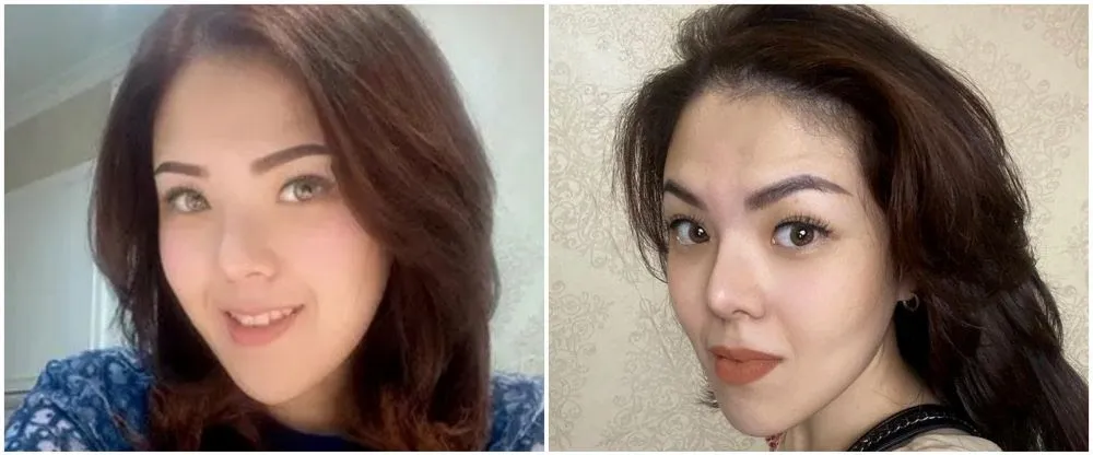 15 potret wajah seleb oplas dagu © 2025 brilio.net