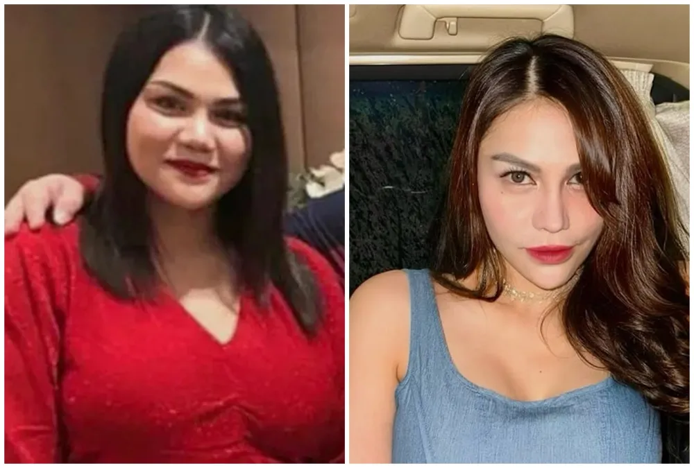 15 potret wajah seleb oplas dagu © 2025 brilio.net